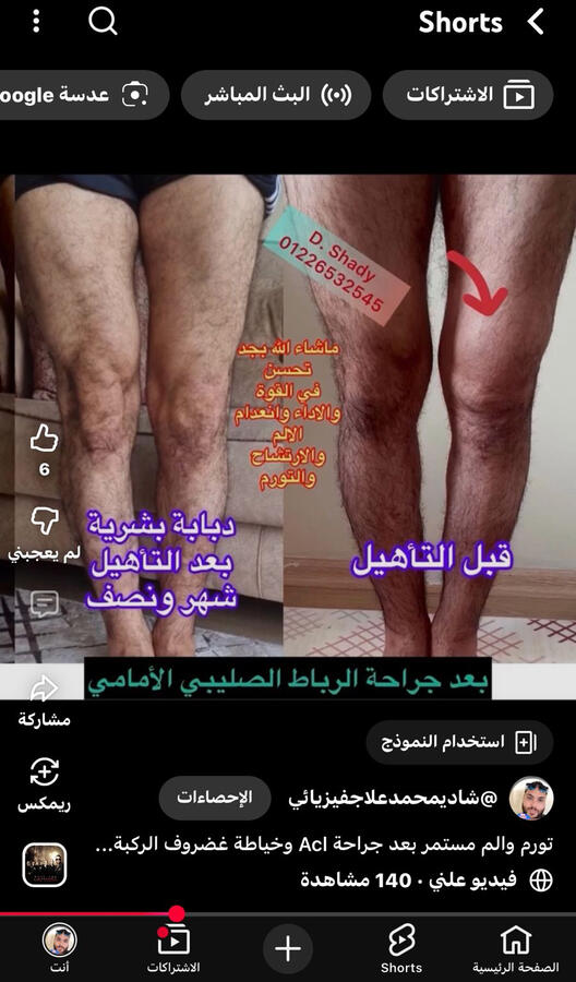 مهما كانت مشكلة ركبتك احنا متمكنين جدا وهنرجعك وبنوعدك