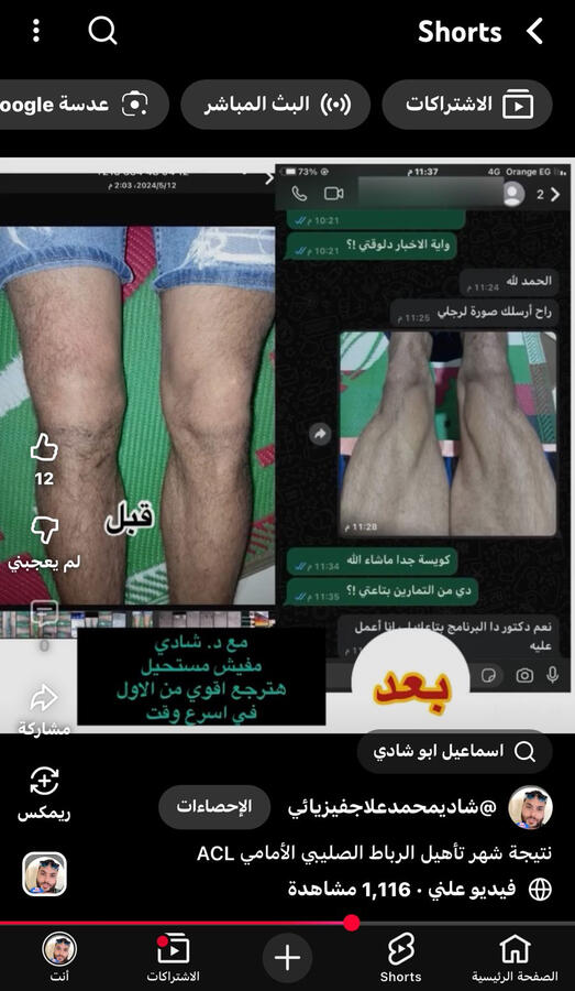 مفيش تورم ومفيش ضمور معانا .. ولو عندك ضمور وتورم الحق نفسك لانها من علامات الخشونه ✅