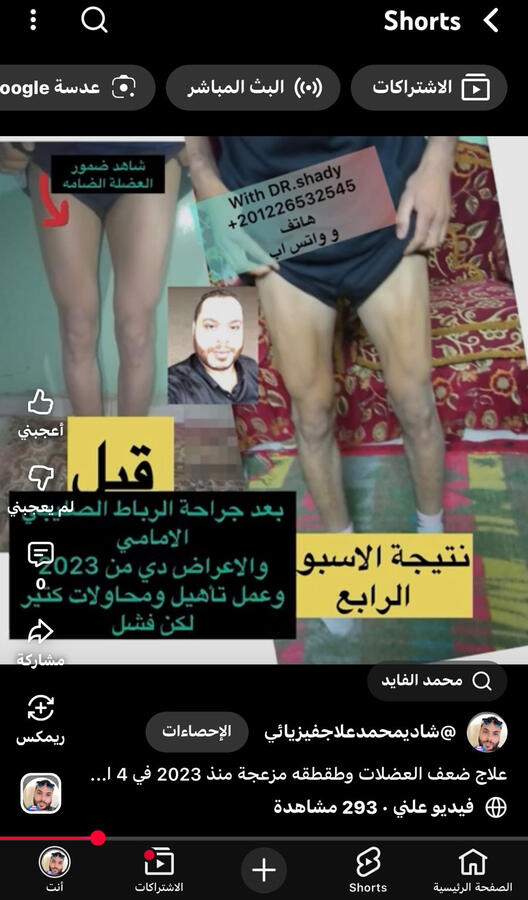بتيجي لنا بضمور عضلات وتورم ونرجعك اقوي وافضل وعندك عضلات تتفاخر بيها
